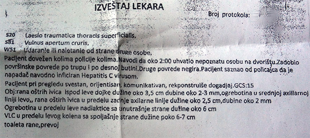 Kako izgleda kada vam razbojnik u 2 ujutru upadne u dvorište...