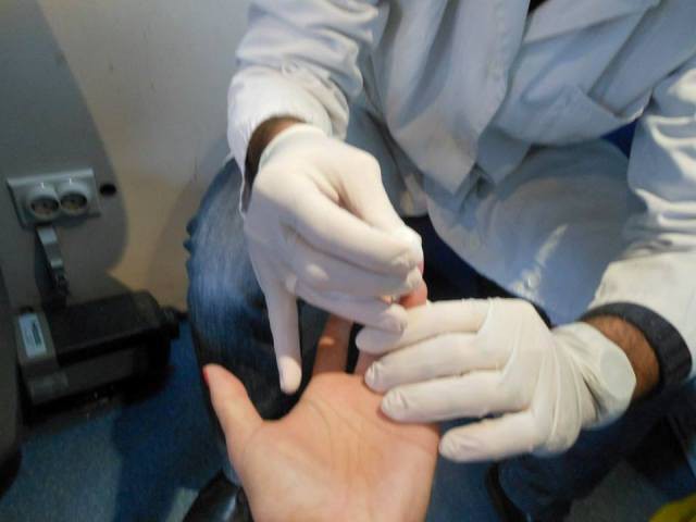 Kampanja za 1.decembar: testiranje na HIV