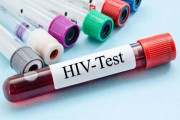 Besplatno anonimno testiranje na HIV