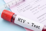 Besplatno testiranje na HIV i hepatitis B i C u ponedeljak