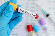 U ponedeljak besplatno testiranje na HIV i hepatitis B i C