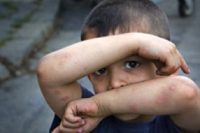 Nasilje nad decom u porastu