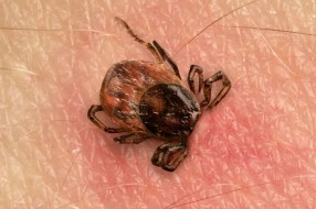 Krpelji sve aktivniji - kako prepoznati lajmsku bolest?