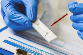 Od sutra dostupno testiranje prisustva antitela na korona virus