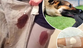 Razulareni psi napali dvoje ljudi i njihovog psa tokom šetnje Kelebijskom šumom