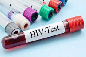 Besplatno anonimno testiranje na HIV