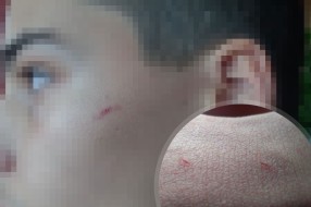 Nastavnik OŠ “Jovan Jovanović Zmaj” fizički napao đaka