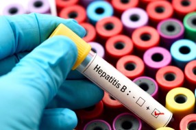 Besplatno testiranje na hepatitis u četvrtak