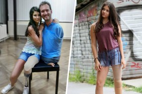 Trinaestogodišnja Biljana je izgubila nogu zbog raka, ali danas se još više raduje životu