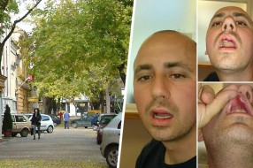 Fizički napadnut predsednik Okružnog odbora SRS
