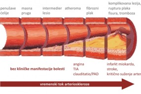 Zabranjen rad lekarima Preventmeda iz Subotice