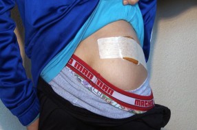 Psi lutalice izujedali trinaestogodišnjaka na Velikom Radanovcu