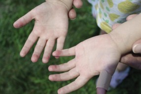 Besplatno savetovalište za atopijski ekcem