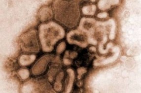 Troje u Bolnici zbog H1N1 - Prijavljena epidemija