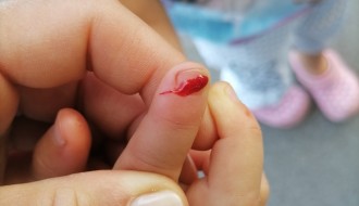 Smeće u parku u Bikovu