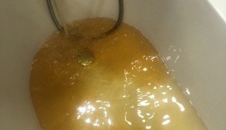 Žuta voda u Velikom Radanovcu