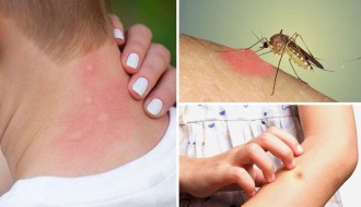 Komarci sve besniji i brojniji, uništavanje slabog efekta