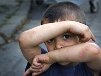 Nasilje nad decom u porastu