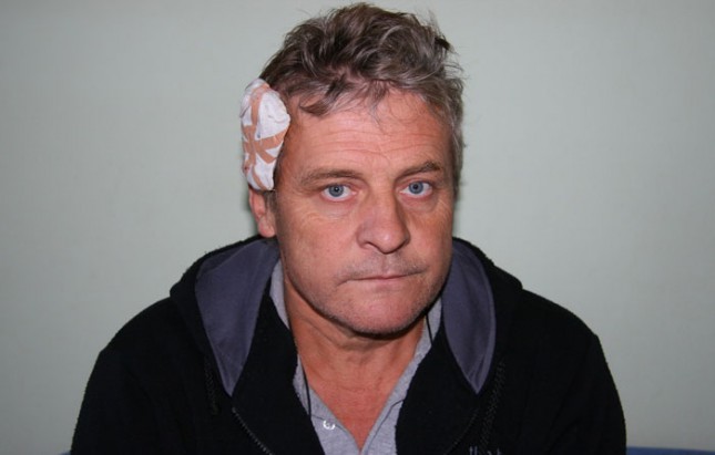 Napadnut taksista subotičkog udruženja