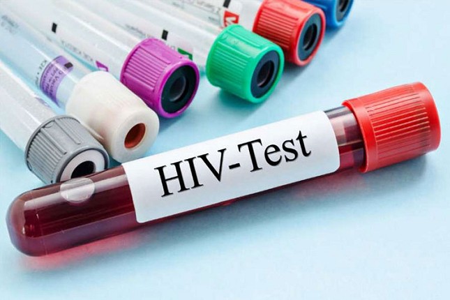 Besplatno anonimno testiranje na HIV
