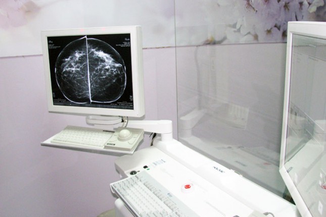 58% žena odbilo mamografiju