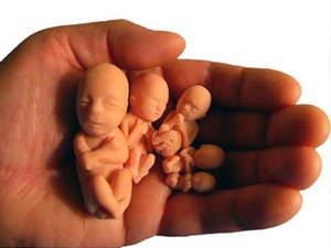 U Subotici oko 500 abortusa godišnje