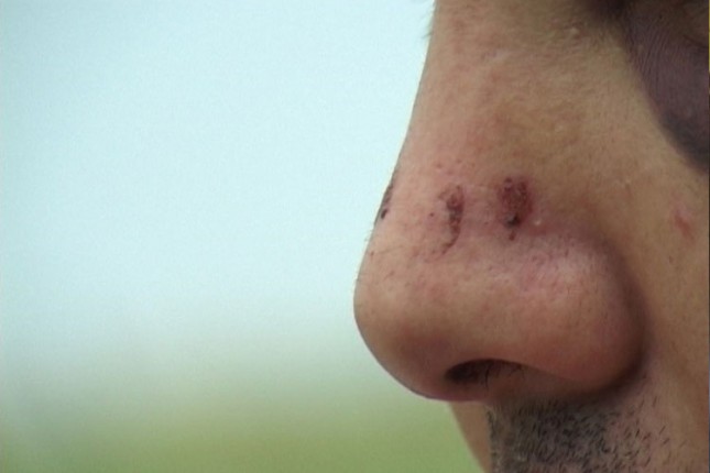 Pretučen i opljačan mladić na Radijalcu