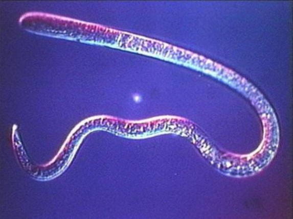 Meso zaraženo trihinelom