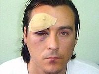 Pretučen na proslavi veridbe