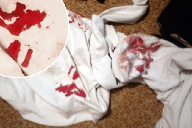 Kukavički napad sedmorice mladića na 17-godišnjaka