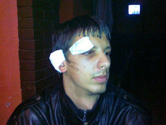 Pretučeni zbog zastave Srbije?