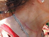 Pokušali da zadave ženu usred dana