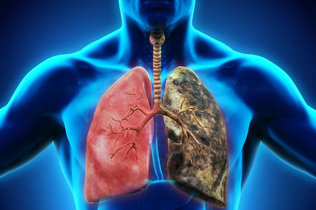 Zajedno smo jači: ujedinjeni za promenu svesti o raku pluća