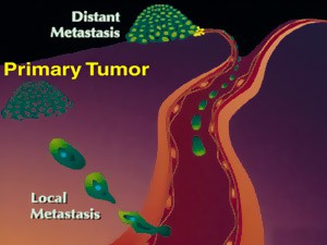 Zdravim načinom života protiv raka