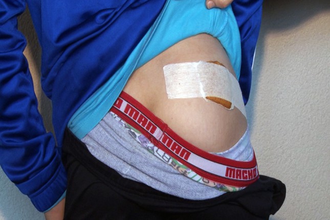 Psi lutalice izujedali trinaestogodišnjaka na Velikom Radanovcu