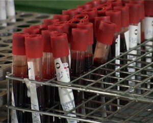 Dovoljno krvi za potrebe pacijenata