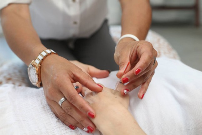 Akupunktura u procesu vantelesne oplodnje