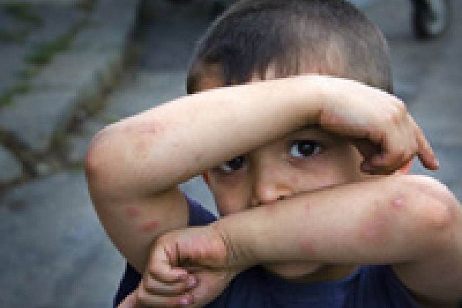 Nasilje nad decom u porastu