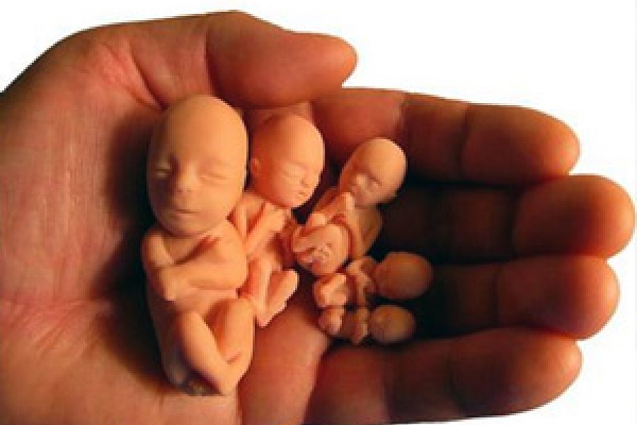 U Subotici oko 500 abortusa godišnje