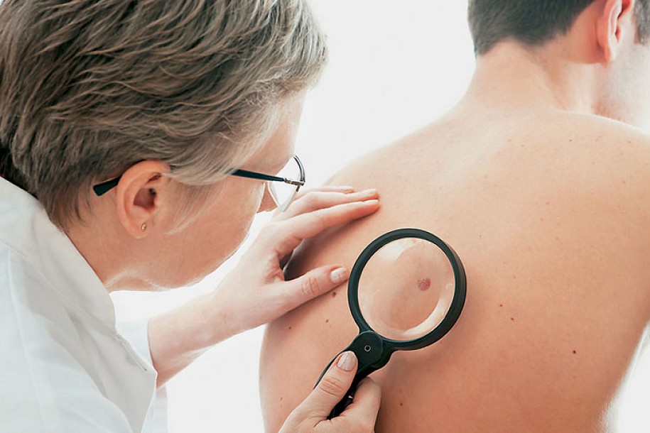 Predavanje povodom obeležavanja Dana borbe protiv malignog melanoma