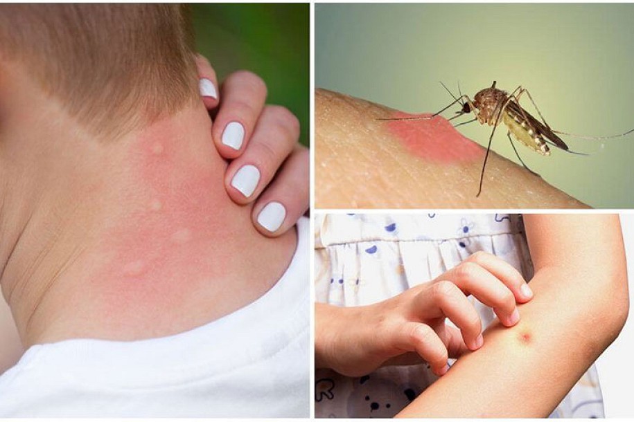 Virus groznice Zapadnog Nila prisutan, za sada nema obolelih