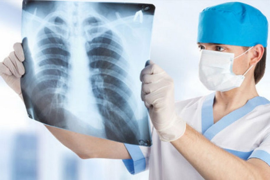 Sutra se obeležava Svetski dan borbe protiv tuberkuloze
