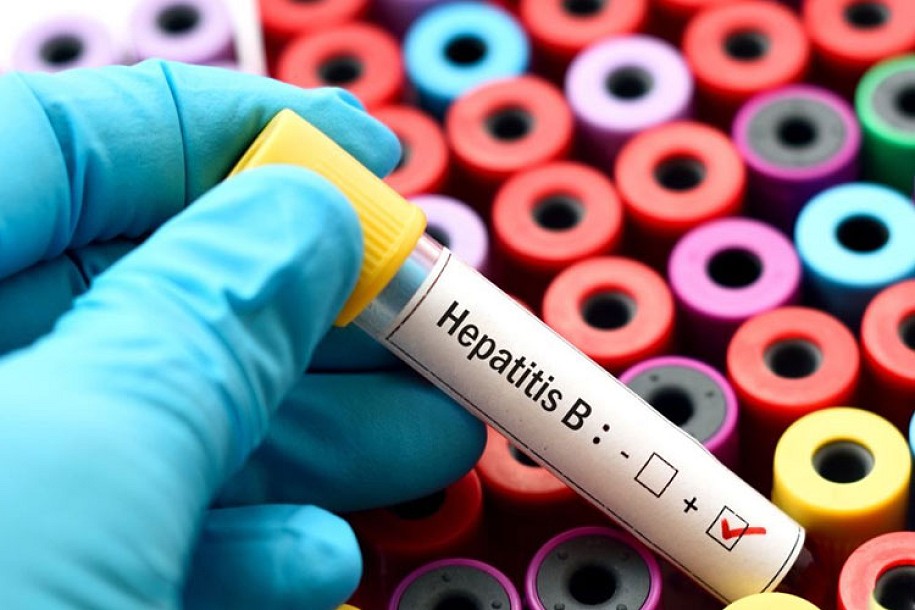 Besplatno testiranje na hepatitis u četvrtak