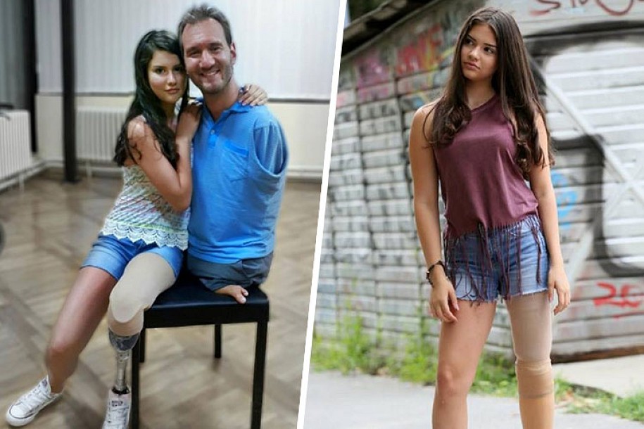 Trinaestogodišnja Biljana je izgubila nogu zbog raka, ali danas se još više raduje životu