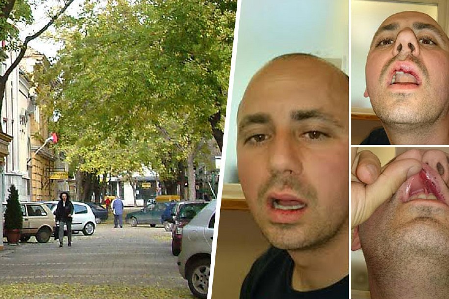 Fizički napadnut predsednik Okružnog odbora SRS