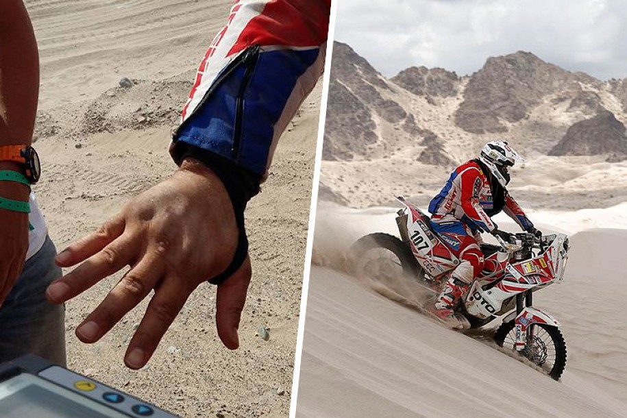 Sagmajster ponovo polomio šaku, ali nastavlja Dakar