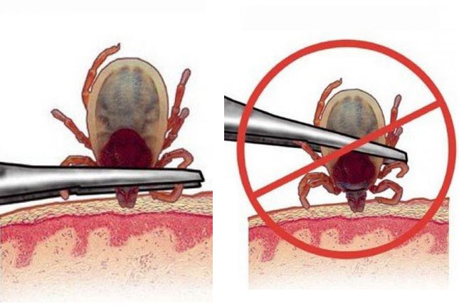 Ujed krpelja je potencijalno opasan