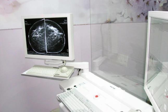 Većina promena na dojkama nije karcinom, ali svaka promena zahteva neodložnu posetu lekaru