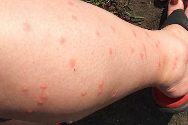 Nastavak akcije suzbijanja komaraca u gradskim naseljima i na Paliću od ponedeljka