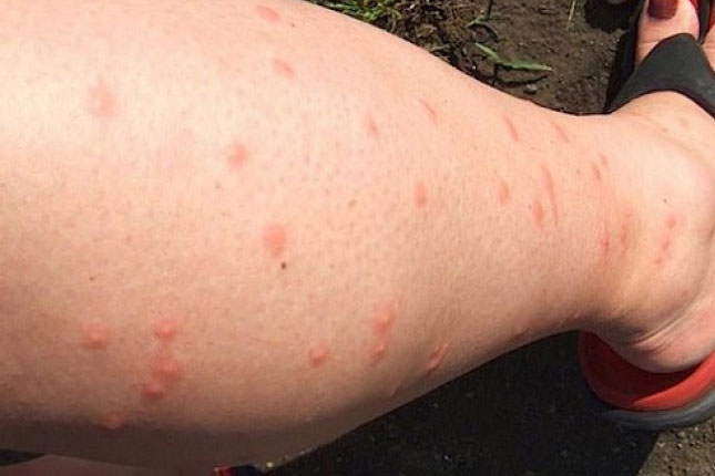 Nastavak akcije suzbijanja komaraca u gradskim naseljima i na Paliću od ponedeljka